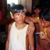 Yanomami lernen eine Injektion in den Oberarm zu geben.