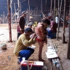 A medical assistant gathers a skin sample for Onkozerkose testing.