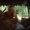 Otros yanomami de aldeas adyacentes también son atendidos desde el dispensario. Además de Malaria, muchos yanomami en la región del Orinoco padecen de Oncocercosis (ceguera de los ríos).